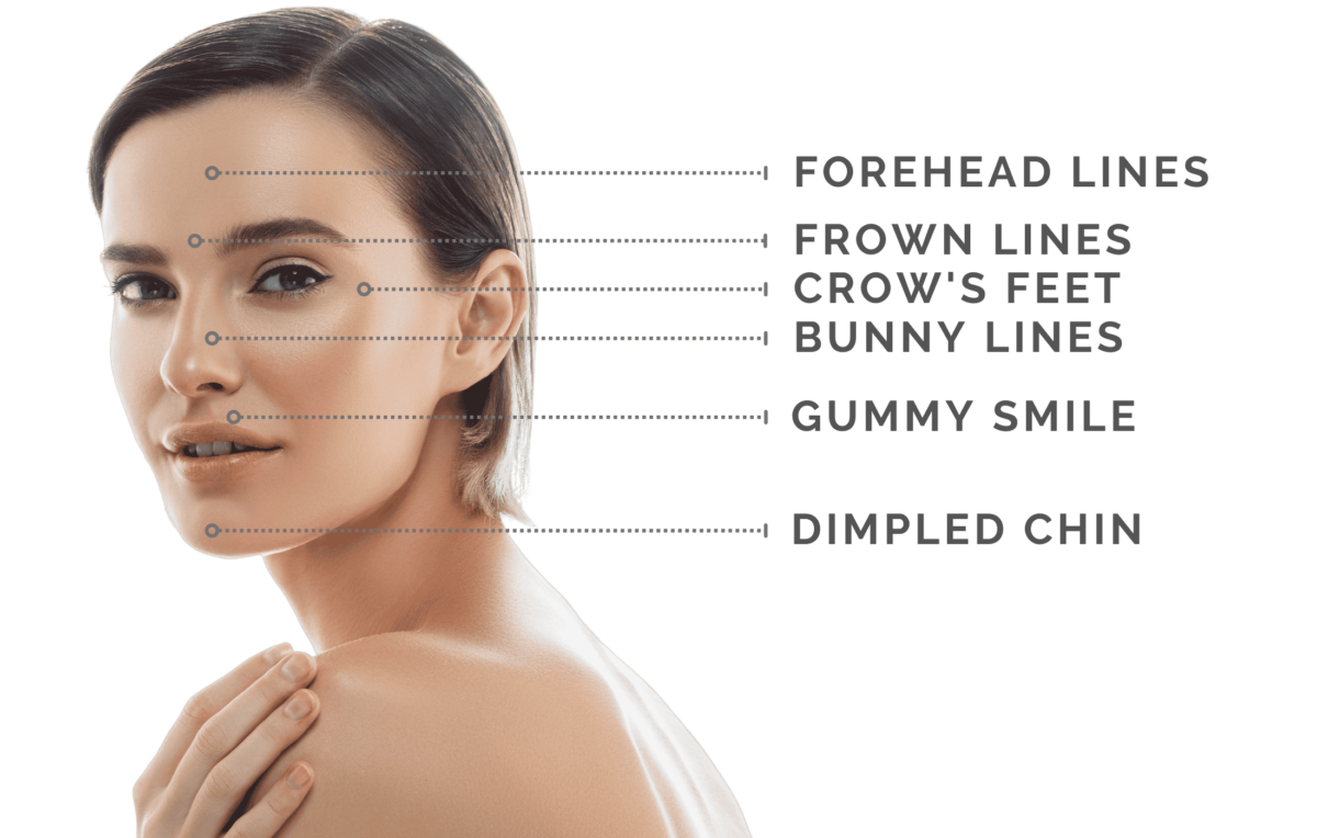 Botox in Naples FL