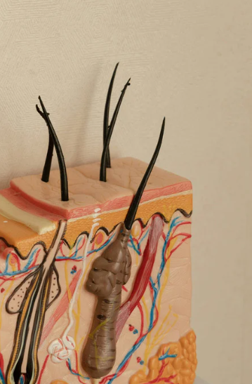 FUE Hair Transplant in Naples, FL